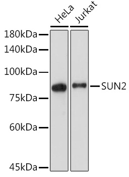 Western blot analysis of various lysates using SUN2 Rabbit mAb at 1:2000 dilution.|Secondary antibody: HRP-conjugated Goat anti-Rabbit IgG (H+L) at 1:10000 dilution.|Lysates/proteins: 25μg per lane.|Blocking buffer: 3% nonfat dry milk in TBST.|Detection: ECL Enhanced Kit.|Exposure time: 60s.