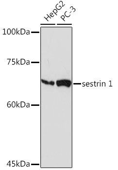 Western blot analysis of various lysates using sestrin 1 Rabbit mAb at 1:1000 dilution.|Secondary antibody: HRP-conjugated Goat anti-Rabbit IgG (H+L) at 1:10000 dilution.|Lysates/proteins: 25μg per lane.|Blocking buffer: 3% nonfat dry milk in TBST.|Detection: ECL Basic Kit.|Exposure time: 180s.