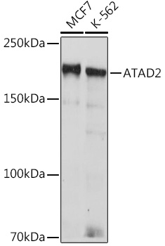 Western blot analysis of various lysates using ATAD2 Rabbit mAb at 1:1000 dilution incubated overnight at 4°C.|Secondary antibody: HRP-conjugated Goat anti-Rabbit IgG (H+L) at 1:10000 dilution.|Lysates/proteins: 25μg per lane.|Blocking buffer: 3% nonfat dry milk in TBST.|Detection: ECL Basic Kit.|Exposure time: 90s.