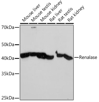 Western blot analysis of various lysates using Renalase Rabbit mAb at 1:1000 dilution.|Secondary antibody: HRP-conjugated Goat anti-Rabbit IgG (H+L) at 1:10000 dilution.|Lysates/proteins: 25μg per lane.|Blocking buffer: 3% nonfat dry milk in TBST.|Detection: ECL Basic Kit.|Exposure time: 10s.