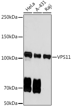 Western blot analysis of various lysates using VPS11 Rabbit mAb (A19798) at 1:1000 dilution.|Secondary antibody: HRP-conjugated Goat anti-Rabbit IgG (H+L) (AS014) at 1:10000 dilution.|Lysates/proteins: 25μg per lane.|Blocking buffer: 3% nonfat dry milk in TBST.|Detection: ECL Basic Kit (RM00020).|Exposure time: 60s.