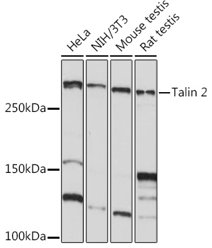 Western blot analysis of various lysates using Talin 2 Rabbit mAb at 1:1000 dilution.|Secondary antibody: HRP-conjugated Goat anti-Rabbit IgG (H+L) at 1:10000 dilution.|Lysates/proteins: 25μg per lane.|Blocking buffer: 3% nonfat dry milk in TBST.|Detection: ECL Basic Kit.|Exposure time: 10s.