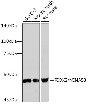 Western blot analysis of various lysates using RIOX2/RIOX2/MINA53 Rabbit mAb at 1:1000 dilution.|Secondary antibody: HRP-conjugated Goat anti-Rabbit IgG (H+L) at 1:10000 dilution.|Lysates/proteins: 25μg per lane.|Blocking buffer: 3% nonfat dry milk in TBST.|Detection: ECL Basic Kit.|Exposure time: 90s.