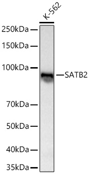 Western blot analysis of lysates from K-562 cells using SATB2 Rabbit mAb at 1:1000 dilution incubated overnight at 4℃.|Secondary antibody: HRP-conjugated Goat anti-Rabbit IgG (H+L) at 1:10000 dilution.|Lysates/proteins: 25 μg per lane.|Blocking buffer: 3% nonfat dry milk in TBST.|Detection: ECL Basic Kit.|Exposure time: 60s.