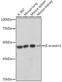 Western blot analysis of various lysates using β-arrestin1 Rabbit mAb (A10742) at 1:1000 dilution.|Secondary antibody: HRP-conjugated Goat anti-Rabbit IgG (H+L) (AS014) at 1:10000 dilution.|Lysates/proteins: 25μg per lane.|Blocking buffer: 3% nonfat dry milk in TBST.|Detection: ECL Basic Kit (RM00020).|Exposure time: 3s.