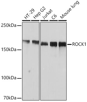 Western blot analysis of various lysates using ROCK1 Rabbit mAb (A11158) at 1:1000 dilution.|Secondary antibody: HRP-conjugated Goat anti-Rabbit IgG (H+L) (AS014) at 1:10000 dilution.|Lysates/proteins: 25μg per lane.|Blocking buffer: 3% nonfat dry milk in TBST.|Detection: ECL Basic Kit (RM00020).|Exposure time: 1s.