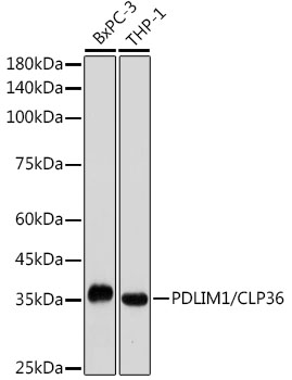 Western blot analysis of various lysates using PDLIM1/CLP36 Rabbit mAb at 1:1000 dilution.|Secondary antibody: HRP-conjugated Goat anti-Rabbit IgG (H+L) at 1:10000 dilution.|Lysates/proteins: 25μg per lane.|Blocking buffer: 3% nonfat dry milk in TBST.|Detection: ECL Basic Kit.|Exposure time: 10s.