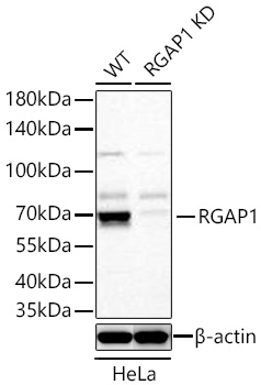 Western blot analysis of lysates from wild type (WT) and RGAP1 knockdown (KD) HeLa cells using RGAP1 Rabbit mAb at 1:1000 dilution incubated overnight at 4℃.|Secondary antibody: HRP-conjugated Goat anti-Rabbit IgG (H+L) at 1:10000 dilution.|Lysates/proteins: 25 μg per lane.|Blocking buffer: 3% nonfat dry milk in TBST.|Detection: ECL Basic Kit.|Exposure time: 20 s.