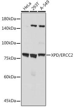 Western blot analysis of various lysates using XPD/ERCC2 Rabbit mAb (A19241) at 1:1000 dilution.|Secondary antibody: HRP-conjugated Goat anti-Rabbit IgG (H+L) (AS014) at 1:10000 dilution.|Lysates/proteins: 25μg per lane.|Blocking buffer: 3% nonfat dry milk in TBST.|Detection: ECL Basic Kit (RM00020).|Exposure time: 10s.