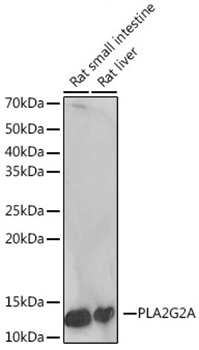 Western blot analysis of various lysates using PLA2G2A Rabbit mAb at 1:1000 dilution  incubated overnight at 4℃.|Secondary antibody: HRP-conjugated Goat anti-Rabbit IgG (H+L) at 1:10000 dilution.|Lysates/proteins: 25μg per lane.|Blocking buffer: 3% nonfat dry milk in TBST.|Detection: ECL Basic Kit.|Exposure time: 5 s.