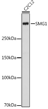Western blot analysis of various lysates using SMG1 Rabbit mAb at 1:1000 dilution.|Secondary antibody: HRP-conjugated Goat anti-Rabbit IgG (H+L) at 1:10000 dilution.|Lysates/proteins: 25μg per lane.|Blocking buffer: 3% nonfat dry milk in TBST.|Detection: ECL Basic Kit.|Exposure time: 10s.