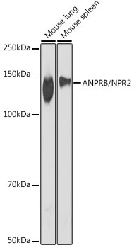 Western blot analysis of various lysates using ANPRB/NPR2 Rabbit mAb at 1:1000 dilution.|Secondary antibody: HRP-conjugated Goat anti-Rabbit IgG (H+L) at 1:10000 dilution.|Lysates/proteins: 25μg per lane.|Blocking buffer: 3% nonfat dry milk in TBST.|Detection: ECL Basic Kit.|Exposure time: 90s.