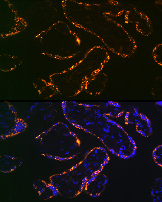 Immunofluorescence analysis of paraffin-embedded human placenta using Placental lactogen (CSH1) (CSH1) Rabbit mAb at dilution of 1:100 (40x lens). Secondary antibody: Cy3-conjugated Goat anti-Rabbit IgG (H+L) at 1:500 dilution. Blue: DAPI for nuclear staining.