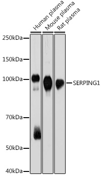 Western blot analysis of various lysates using SERPING1 Rabbit mAb at 1:1000 dilution.|Secondary antibody: HRP-conjugated Goat anti-Rabbit IgG (H+L) at 1:10000 dilution.|Lysates/proteins: 25μg per lane.|Blocking buffer: 3% nonfat dry milk in TBST.|Detection: ECL Basic Kit.|Exposure time: 30s.