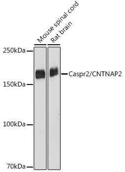 Western blot analysis of various lysates using Caspr2/CNTNAP2 Rabbit mAb at 1:1000 dilution.|Secondary antibody: HRP-conjugated Goat anti-Rabbit IgG (H+L) at 1:10000 dilution.|Lysates/proteins: 25μg per lane.|Blocking buffer: 3% nonfat dry milk in TBST.|Detection: ECL Basic Kit.|Exposure time: 10s.