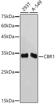Western blot analysis of various lysates using CBR1 Rabbit mAb at 1:1000 dilution.|Secondary antibody: HRP-conjugated Goat anti-Rabbit IgG (H+L) at 1:10000 dilution.|Lysates/proteins: 25μg per lane.|Blocking buffer: 3% nonfat dry milk in TBST.|Detection: ECL Basic Kit.|Exposure time: 10s.
