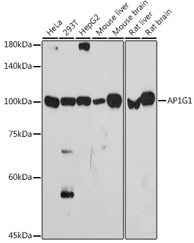 Western blot analysis of various lysates using AP1G1 Rabbit mAb at 1:1000 dilution.|Secondary antibody: HRP-conjugated Goat anti-Rabbit IgG (H+L) at 1:10000 dilution.|Lysates/proteins: 25μg per lane.|Blocking buffer: 3% nonfat dry milk in TBST.|Detection: ECL Basic Kit.|Exposure time: 90s.