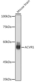 Western blot analysis of lysates from Mouse brain, using ACVR1 Rabbit mAb at1:1000 dilution.|Secondary antibody: HRP-conjugated Goat anti-Rabbit IgG (H+L) at1:10000 dilution.|Lysates/proteins: 25μg per lane.|Blocking buffer: 3% nonfat dry milk in TBST.|Detection: ECL Basic Kit.|Exposure time: 1s.