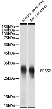 Western blot analysis of various lysates using PRSS2 Rabbit mAb at 1:5000 dilution.|Secondary antibody: HRP-conjugated Goat anti-Rabbit IgG (H+L) at 1:10000 dilution.|Lysates/proteins: 25μg per lane.|Blocking buffer: 3% nonfat dry milk in TBST.|Detection: ECL Basic Kit.|Exposure time: 1s.