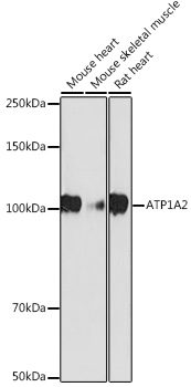 Western blot analysis of various lysates using ATP1A2 Rabbit mAb at 1:1000 dilution.|Secondary antibody: HRP-conjugated Goat anti-Rabbit IgG (H+L) at 1:10000 dilution.|Lysates/proteins: 25μg per lane.|Blocking buffer: 3% nonfat dry milk in TBST.|Detection: ECL Basic Kit.|Exposure time: 180s.
