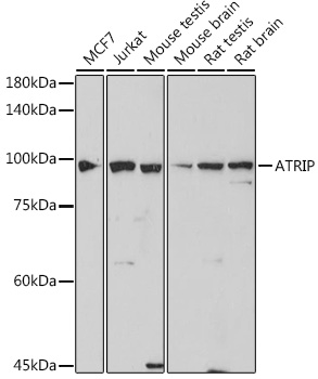 Western blot analysis of various lysates, using ATRIP Rabbit mAb at 1:1000 dilution.|Secondary antibody: HRP-conjugated Goat anti-Rabbit IgG (H+L) at 1:10000 dilution.|Lysates/proteins: 25μg per lane.|Blocking buffer: 3% nonfat dry milk in TBST.|Detection: ECL Basic Kit.|Exposure time: 30s.