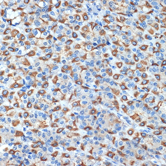 Immunohistochemistry analysis of paraffin-embedded Rat stomach using ATP4B Rabbit mAb at dilution of 1:100 (40x lens). Microwave antigen retrieval performed with 0.01M Tris/EDTA Buffer (pH 9.0) prior to IHC staining.