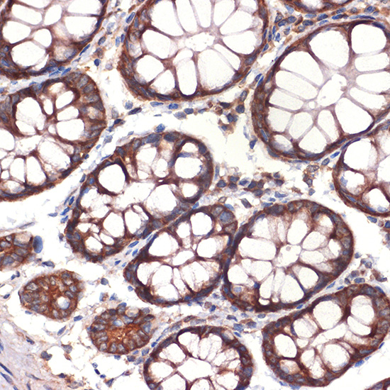 Immunohistochemistry analysis of paraffin-embedded Human colon using CC2D1A Rabbit mAb at dilution of 1:100 (40x lens). Microwave antigen retrieval performed with 0.01M Tris/EDTA Buffer (pH 9.0) prior to IHC staining.