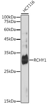 Western blot analysis of lysates from HCT116 cells, using RCHY1 Rabbit mAb at 1:1000 dilution.|Secondary antibody: HRP-conjugated Goat anti-Rabbit IgG (H+L) at 1:10000 dilution.|Lysates/proteins: 25μg per lane.|Blocking buffer: 3% nonfat dry milk in TBST.|Detection: ECL Basic Kit.|Exposure time: 180s.