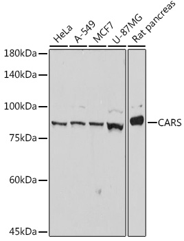 Western blot analysis of various lysates using CARS Rabbit mAb at 1:1000 dilution.|Secondary antibody: HRP-conjugated Goat anti-Rabbit IgG (H+L) at 1:10000 dilution.|Lysates/proteins: 25μg per lane.|Blocking buffer: 3% nonfat dry milk in TBST.|Detection: ECL Basic Kit.|Exposure time: 3s.