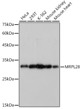 Western blot analysis of various lysates using MRPL28 Rabbit mAb at 1:1000 dilution.|Secondary antibody: HRP-conjugated Goat anti-Rabbit IgG (H+L) at 1:10000 dilution.|Lysates/proteins: 25μg per lane.|Blocking buffer: 3% nonfat dry milk in TBST.|Detection: ECL Basic Kit.|Exposure time: 1s.