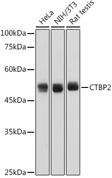 Western blot analysis of various lysates using CTBP2 Rabbit mAb at 1:1000 dilution.|Secondary antibody: HRP-conjugated Goat anti-Rabbit IgG (H+L) at 1:10000 dilution.|Lysates/proteins: 25μg per lane.|Blocking buffer: 3% nonfat dry milk in TBST.|Detection: ECL Basic Kit.|Exposure time: 1s.