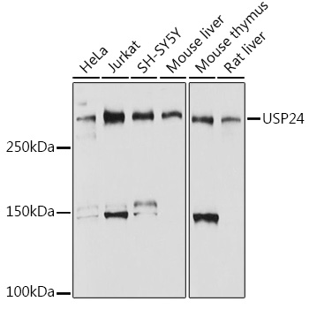 Western blot analysis of various lysates, using USP24 Rabbit mAb (A0621) at 1:1000 dilution.|Secondary antibody: HRP-conjugated Goat anti-Rabbit IgG (H+L) (AS014) at 1:10000 dilution.|Lysates/proteins: 25μg per lane.|Blocking buffer: 3% nonfat dry milk in TBST.|Detection: ECL Basic Kit (RM00020).|Exposure time: 1s.