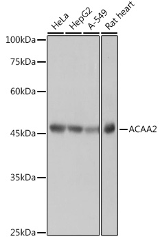 Western blot analysis of various lysates using ACAA2 Rabbit mAb at 1:1000 dilution.|Secondary antibody: HRP-conjugated Goat anti-Rabbit IgG (H+L) at 1:10000 dilution.|Lysates/proteins: 25μg per lane.|Blocking buffer: 3% nonfat dry milk in TBST.|Detection: ECL Basic Kit.|Exposure time: 1s.