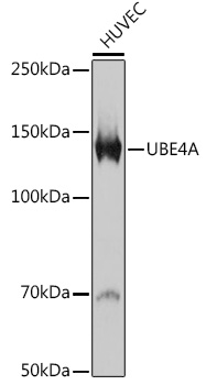Western blot analysis of lysates from HUVEC cells, using UBE4A Rabbit mAb (A0710) at 1:1000 dilution.|Secondary antibody: HRP-conjugated Goat anti-Rabbit IgG (H+L) (AS014) at 1:10000 dilution.|Lysates/proteins: 25μg per lane.|Blocking buffer: 3% nonfat dry milk in TBST.|Detection: ECL Basic Kit (RM00020).|Exposure time: 90s.