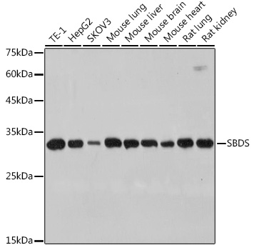 Western blot analysis of various lysates using SBDS Rabbit mAb at 1:1000 dilution.|Secondary antibody: HRP-conjugated Goat anti-Rabbit IgG (H+L) at 1:10000 dilution.|Lysates/proteins: 25μg per lane.|Blocking buffer: 3% nonfat dry milk in TBST.|Detection: ECL Basic Kit.|Exposure time: 5s.