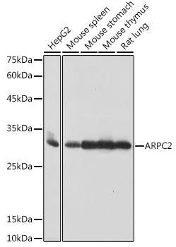 Western blot analysis of various lysates using ARPC2 Rabbit mAb at 1:1000 dilution.|Secondary antibody: HRP-conjugated Goat anti-Rabbit IgG (H+L) at 1:10000 dilution.|Lysates/proteins: 25μg per lane.|Blocking buffer: 3% nonfat dry milk in TBST.|Detection: ECL Basic Kit.|Exposure time: 1s.