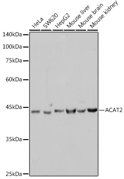 Western blot analysis of various lysates using ACAT2 Rabbit mAb at 1:1000 dilution.|Secondary antibody: HRP-conjugated Goat anti-Rabbit IgG (H+L) at 1:10000 dilution.|Lysates/proteins: 25μg per lane.|Blocking buffer: 3% nonfat dry milk in TBST.|Detection: ECL Basic Kit.|Exposure time: 10s.