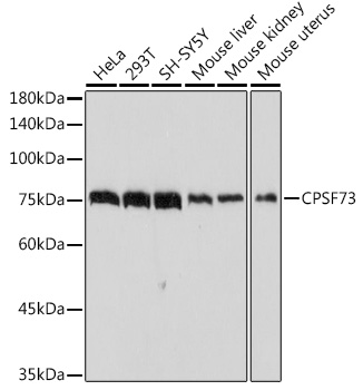 Western blot analysis of various lysates using CPSF73 Rabbit mAb at 1:1000 dilution.|Secondary antibody: HRP-conjugated Goat anti-Rabbit IgG (H+L) at 1:10000 dilution.|Lysates/proteins: 25μg per lane.|Blocking buffer: 3% nonfat dry milk in TBST.|Detection: ECL Basic Kit.|Exposure time: 3s.