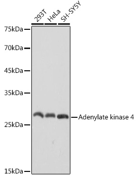 Western blot analysis of various lysates using Adenylate kinase 4 Rabbit mAb at 1:1000 dilution.|Secondary antibody: HRP-conjugated Goat anti-Rabbit IgG (H+L) at 1:10000 dilution.|Lysates/proteins: 25μg per lane.|Blocking buffer: 3% nonfat dry milk in TBST.|Detection: ECL Basic Kit.|Exposure time: 1s.