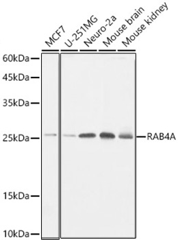 Western blot analysis of various lysates, using RAB4A Rabbit mAb at 1:1000 dilution.|Secondary antibody: HRP-conjugated Goat anti-Rabbit IgG (H+L) at 1:10000 dilution.|Lysates/proteins: 25μg per lane.|Blocking buffer: 3% nonfat dry milk in TBST.|Detection: ECL Basic Kit.|Exposure time: 1s.