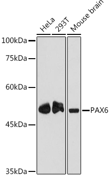 Western blot analysis of various lysates using PAX6 Rabbit mAb at 1:1000 dilution.|Secondary antibody: HRP-conjugated Goat anti-Rabbit IgG (H+L) at 1:10000 dilution.|Lysates/proteins: 25μg per lane.|Blocking buffer: 3% nonfat dry milk in TBST.|Detection: ECL Enhanced Kit.|Exposure time: 180s.