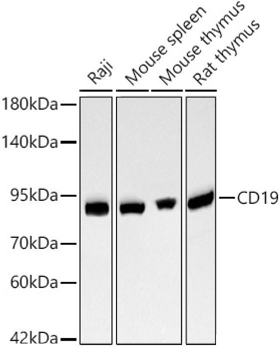 Western blot analysis of various lysates using CD19 Rabbit mAb at 1:1000 dilution incubated overnight at 4℃.|Secondary antibody: HRP-conjugated Goat anti-Rabbit IgG (H+L) at 1:10000 dilution.|Lysates/proteins: 25 μg per lane.|Blocking buffer: 3% nonfat dry milk in TBST.|Detection: ECL Basic Kit.|Exposure time: 30s.