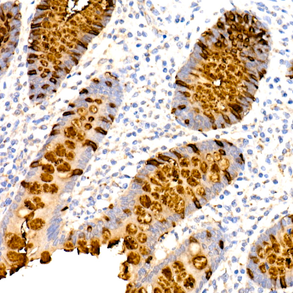 Immunohistochemistry analysis of paraffin-embedded Human appendix using TFF3 Rabbit mAb (A4592) at dilution of 1:100 (40x lens). High pressure antigen retrieval performed with 0.01M Tris/EDTA Buffer (pH 9.0) prior to IHC staining.