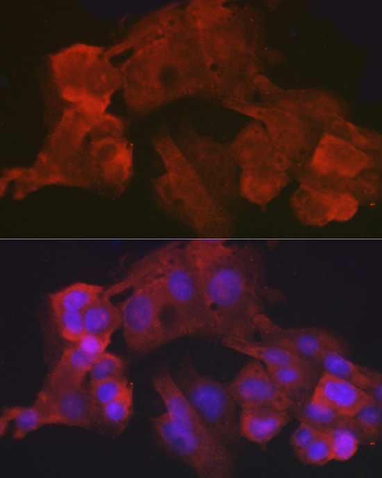 Immunofluorescence analysis of HepG2 cells using Villin1 Rabbit mAb (A4691) at dilution of 1:100 (40x lens). Secondary antibody: Cy3-conjugated Goat anti-Rabbit IgG (H+L) (AS007) at 1:500 dilution. Blue: DAPI for nuclear staining.