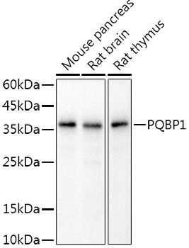 Western blot analysis of  various lysates, using PQBP1 Rabbit mAb at 1:1000 dilution.|Secondary antibody: HRP-conjugated Goat anti-Rabbit IgG (H+L) at 1:10000 dilution.|Lysates/proteins: 25μg  per lane.|Blocking buffer: 3% nonfat dry milk in TBST.|Detection: ECL Basic Kit.|Exposure time: 3s.