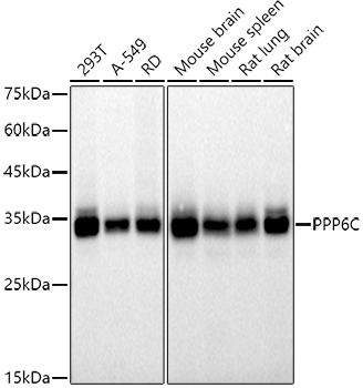 Western blot analysis of various lysates using  at 1:500 dilution.|Secondary antibody: HRP-conjugated Goat anti-Rabbit IgG (H+L) at 1:10000 dilution.|Lysates/proteins: 25μg per lane.|Blocking buffer: 3% nonfat dry milk in TBST.|Detection: ECL Basic Kit.|Exposure time: 10s.