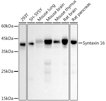 Western blot analysis of various lysates, using Syntaxin 16 Rabbit mAb at 1:500 dilution.Secondary antibody: HRP-conjugated Goat anti-Rabbit IgG (H+L) at 1:10000 dilution.Lysates/proteins: 25μg per lane.Blocking buffer: 3% nonfat dry milk in TBST.Detection: ECL Basic Kit.Exposure time: 10s.