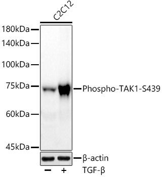 Western blot analysis of various lysates using  at 1:1000 dilution. C2C12 cells were treated with TGF-β (10 ng/ml) at 37℃ for 30 minutes.|Secondary antibody: HRP-conjugated Goat anti-Rabbit IgG (H+L) at 1:10000 dilution.|Lysates/proteins: 25μg per lane.|Blocking buffer: 3% nonfat dry milk in TBST.|Detection: ECL Basic Kit.|Exposure time: 90s.