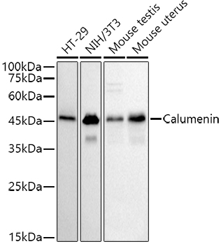 Western blot analysis of various lysates, using  at 1:500 dilution.|Secondary antibody: HRP-conjugated Goat anti-Rabbit IgG (H+L) at 1:10000 dilution.|Lysates/proteins: 25μg per lane.|Blocking buffer: 3% nonfat dry milk in TBST.|Detection: ECL Basic Kit.|Exposure time: 30s.