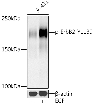 Western blot analysis of lysates from A-431 cells, using Phospho-HER2/ErbB2-Y1139 at 1:500 dilution. A-431 cells were treated with EGF (100 ng/ml) at 37℃ for 30 minutes after serum-starvation overnight.|Secondary antibody: HRP-conjugated Goat anti-Rabbit IgG (H+L) at 1:10000 dilution.|Lysates/proteins: 25μg per lane.|Blocking buffer: 3% nonfat dry milk in TBST.|Detection: ECL Basic Kit.|Exposure time: 90s.